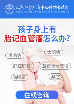 北京治疗血管瘤医院